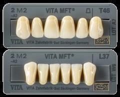 konstrukcji z belkami. Zatrzaski i attachmenty Ceka Preci Line DOBÓR KOLORU ZĘBÓW VITA Easy Shade V Urządzenie do rozpoznawania koloru zębów.