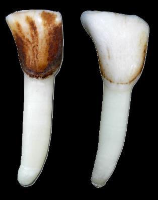 korzeniowy, 7 okostna, 8 powierzchnia ścinająca zęba, 9