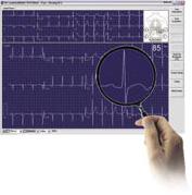 Perfekcyjne badania wysiłkowe Badanie wysiłkowe Program CardioSoft Exercise Stress Testing oferuje znajomy interfejs GE CASE w wydaniu całkowicie programowym.