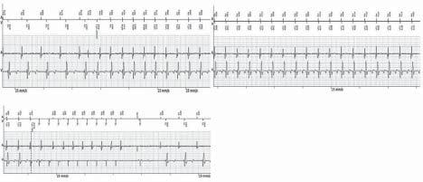 600 Ewa Mroczek et al. PCI-OM nie powiodła się.