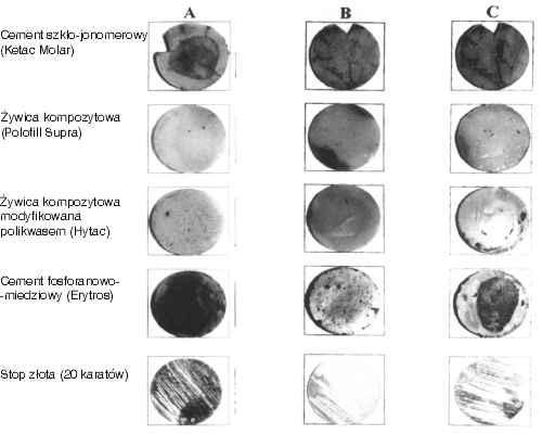 Ryc. 3. Adherencja szczepów Streptococcus mutans (A) i Streptococcus mitis (C) do wybranych materiałów stomatologicznych (C próba kontrolna).