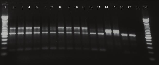 21 29 samples tested; 30, 31 positive control for M. hapla; 32, 33 positive control for M. chitwoodi; 34, 35 positive control for M. fallax; 36 negative PCR control.