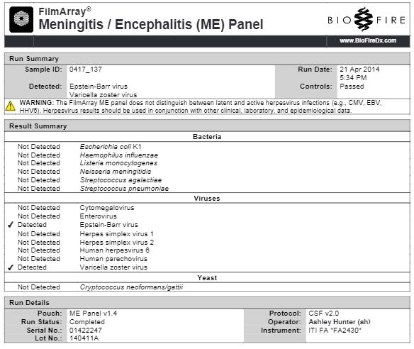 Meningitis