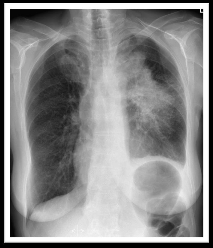 Zdjęcie radiologiczne Podstawową metodą