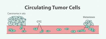 Krążące komórki nowotworowe CTC (circulating tumor cells) oddzielone od guza pierwotnego lub miejsc przerzutów i uwalniane do