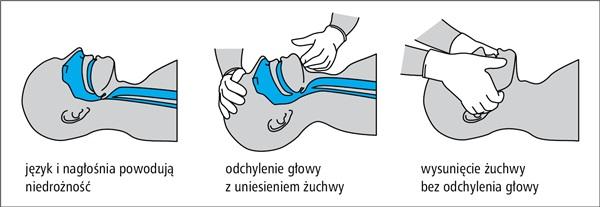 Pomoc medyczna (najważniejsze) Jest to esencja tego, co będzie należało do Waszych głównych obowiązków. Zadbaj o bezpieczeństwo własne (rękawiczki nitrylowe).