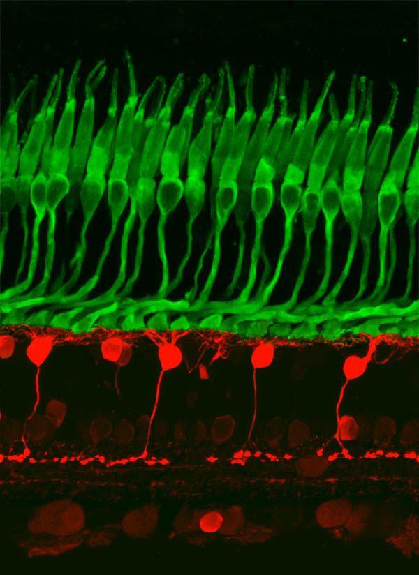 neuron koszyczkowy: wielobiegunowy, interneuron kora mózgowa,