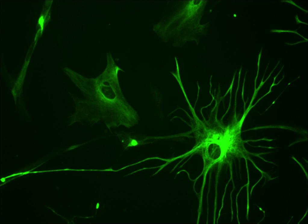 glej makroglej: w ośrodkowym UN: astrocyty funkcja strukturalna, odżywianie, metabolizm, jony, neuroprzekaźniki, modulacja synaps oligodendrocyty (osłonki mielinowe) kom.