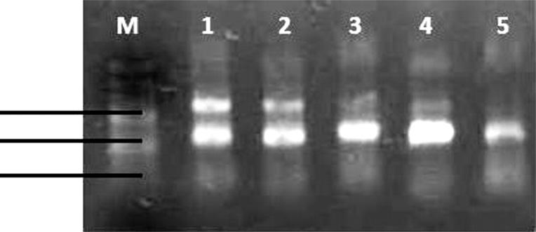 W wyniku przeprowadzonej diagnostyki molekularnej z zastosowaniem starterów ITS uzy skano w reakcji PCR 5 produktów o wielkości zbliżonej do oczekiwanej wartości 470 par zasad.