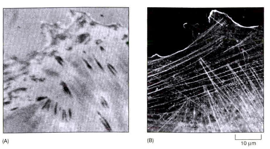 Miejsca kontaktów zogniskowanych - focal contacts