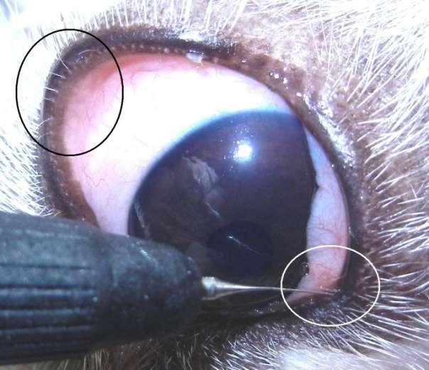 Fot. 2. Distichiasis. Grube, sztywne rzęsy. Kolejną nieprawidłowością rzęs są rzęsy ektopowe (ectopic cilia).