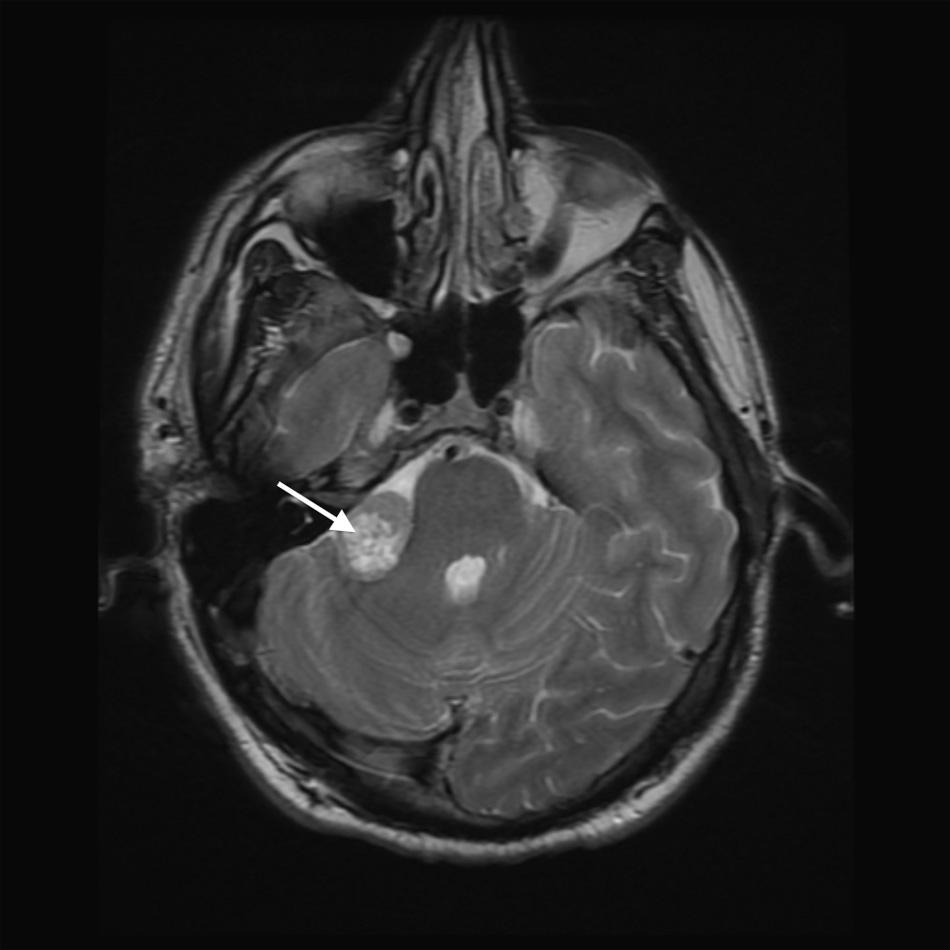 [(Ryc._3)TD$FIG] polski przeglą d otorynolaryngologiczny 2 (2013) 189 193 193 Finansowanie/Financial support Nie występuje.