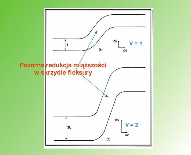 Przekroje przewyższone pozorny