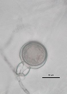 Cechy diagnostyczne wykorzystywane przy identyfikacji morfologicznej Phytophthora spp.