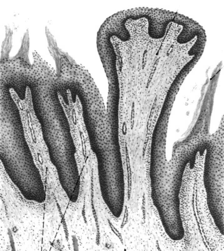 migdałek językowy Rdzeń: mięśnie szkieletowe Powierzchnia dolna: cienka błona śluzowa,