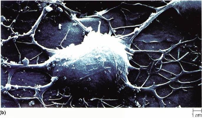 Kolce dendrytyczne Neuron na żywo Co widać?