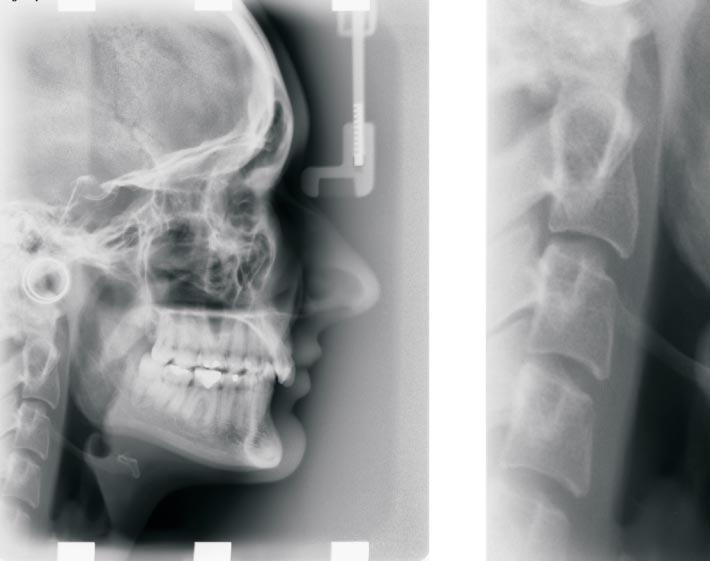 Piœmiennictwo 1. Demczuk P: Ochrona radiologiczna w rentgenodiagnostyce stomatologicznej. Magazyn Stomat., 2003, XIII, 10, 83-84. 2. Garcia-Fernandez P. i wsp.