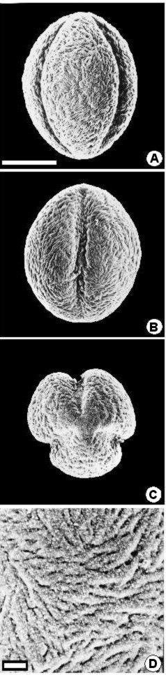 Pollen morphology... 5 S. arranensis S. aucuparia Fig. 1. Outline of pollen grains of S. arranensis and S.