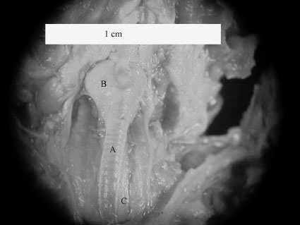 1. Daubenton s bat: A trachea, B larynx, C esophagus, D sternum Ryc. 2.