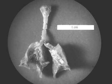 Morfologia dolnych dróg oddechowych... 69 KaŜde z oskrzeli dochodzi do płata płuca, a tam rozdziela się na oskrzela płatowe (bronchi lobares) a dalej na oskrzela segmentowe (bronchi segmentales).