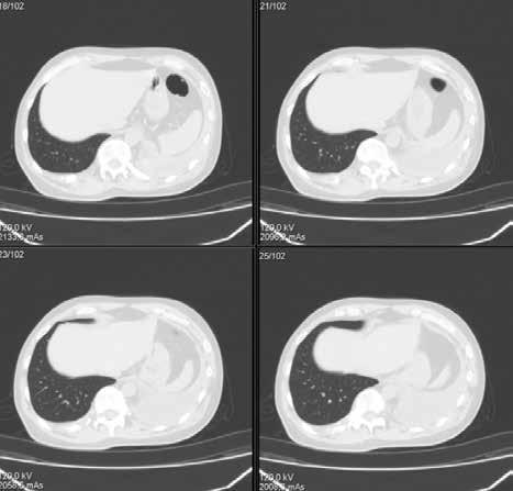 Onkologia w Praktyce Klinicznej 2014, tom 10, supl. G D Rycina 2.