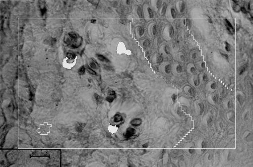 Example of biomedical image analysis detection of skin mast cells calculation of their parameters