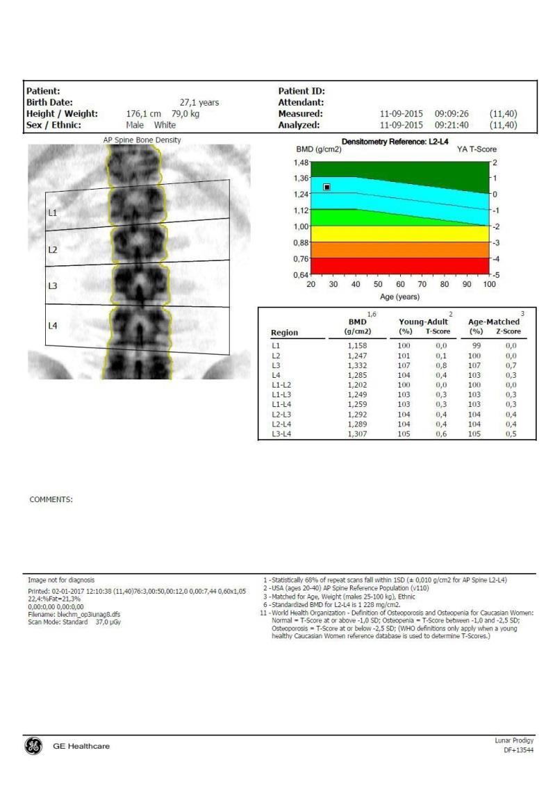 Densytometria