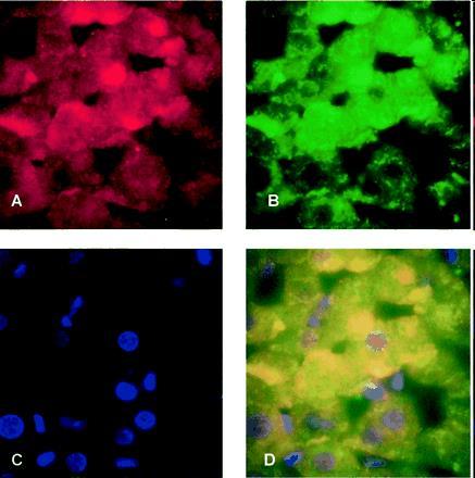 mitochondrialny NOS (mtnos) Nietypowe formy NOS - Barwienia immunohistochemiczne wskazują na istnienie formy mitochondrialnej NOS, która jest aktywna metabolicznie.