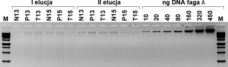 W próbach tych odnotowano także obecność znacznych ilości rybosomalnego RNA. Z tego względu próby mtdna poddano obtrawianiu RNazą A i dodatkowej rundzie oczyszczania na kolumnach adsorpcyjnych.