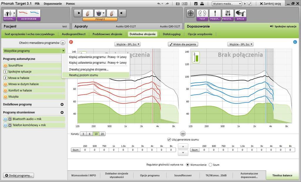 Zmiany dotyczące generatora szumu dokonane w obszarze [Programów automatycznych] zastaną automatycznie zastosowane we wszystkich programach bazowych SoundFlow.