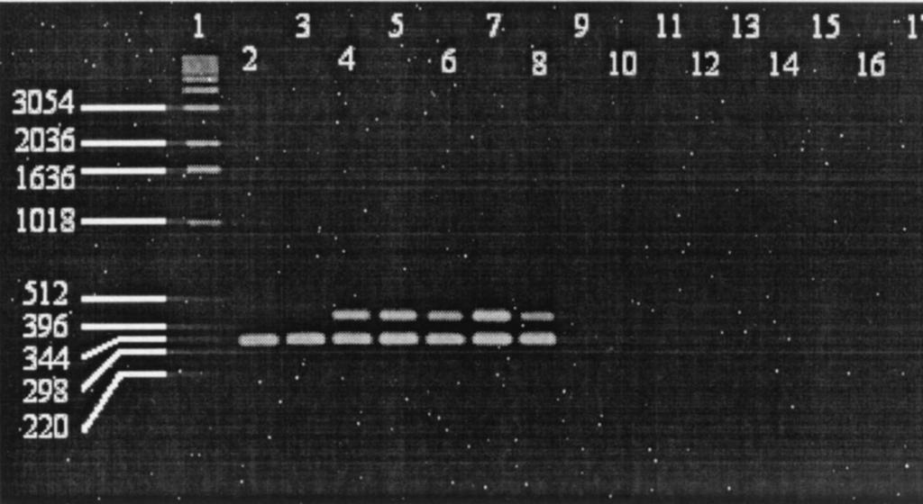 Poz. 1 Marker wielkości, poz. 2 Y. enterocolitica O:5, biotyp 1A; poz. 3 Y. enterocolitica O:8, biotyp 1A poz. 4 Y. enterocolitica O:5,27, biotyp 2; poz. 5 Y.