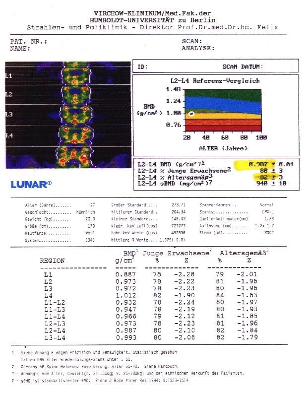 T-score -kobiety po menopauzie -mężczyzni>50rź Z-score -mężczyzni <50rż