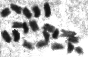 Płytki metafazalne: 11 roślina A-370 z 2n = 20 chromosomów, 12 roślina 8001 z 2n = 29 chromosomów Metaphase