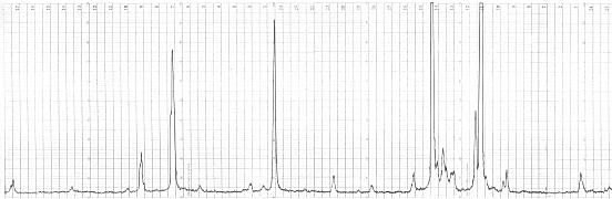 444 (poniżej 30µm) jak i po przeróbce plastycznej (tylko kompozytów zawierających do 2 % Fe). Intensywność 49 47 45 43 41 39 37 35 33 31 29 27 25 23 21 19 17 15 13 11 2θ Rys. 3. Rentgenogram kompozytu po syntezie w temperaturze 780 o C dla układu Al- 11,0%wag FeO TiO 2, - Al, - Al 2 O 3, - Al 3 Ti, -Al 76 Fe 24 Fig.