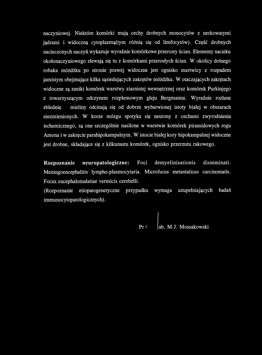 naczyniowej. Niektóre komórki mają cechy drobnych monocytów z nerkowatymi jądrami i widoczną cytoplazmą(tym różnią się od limfocytów).