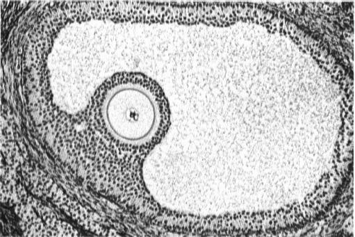 pęcherzykowych, a te przekształcają je w estrogeny (aromatyzacja, enzym - aromataza) Pęcherzyk dojrzały - Graafa (1-7 cm) oocyt otoczony przyszłym wieńcem