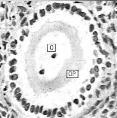 Atrezja pęcherzyków jajnikowych Ciałko żółte komórki ziarnisto-luteinowe