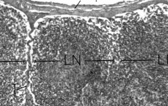 Drogi przepływu chłonki przez węzeł chłonny Recyrkulacja limfocytów tkanka limfoidalna węzła
