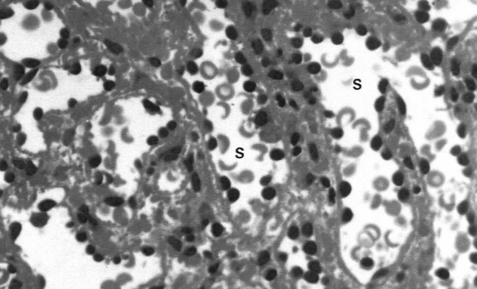 szczelinami międzykomórkowymi okrężne włókna srebrochłonne nieciągła blaszka podstawna T.