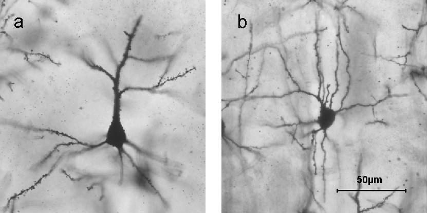 neuron koszyczkowy: GABA-ergiczne koszyczek wokol