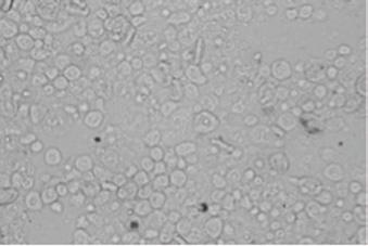 Patologia schorzeń nerek ryb łososiowatych bakteryjna i przerostowa choroba nerek. Fot. 3. Kuliste niedojrzałe spory Tetracapsula bryosalmonae w nerce pstrąga tęczowego (fot. Hanna Głowacka). Fot. 4.