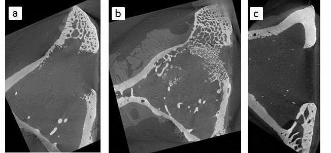 Badania biologiczne (testy in vitro) na komórkach osteoblastopodobnych MG-63 nie wykazały dużych różnić w odpowiedzi komórek na biomateriałów pomiędzy materiałami różnego typu.