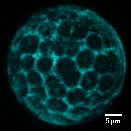 Skrócone białka połączono z białkiem fluorescencyjnym mtfp1 w miejscu brakującej domeny i poddano nadekspresji w protoplastach