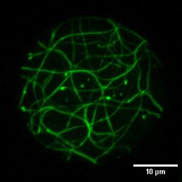 z nadekspresją RIP4-GFP int (n=20).