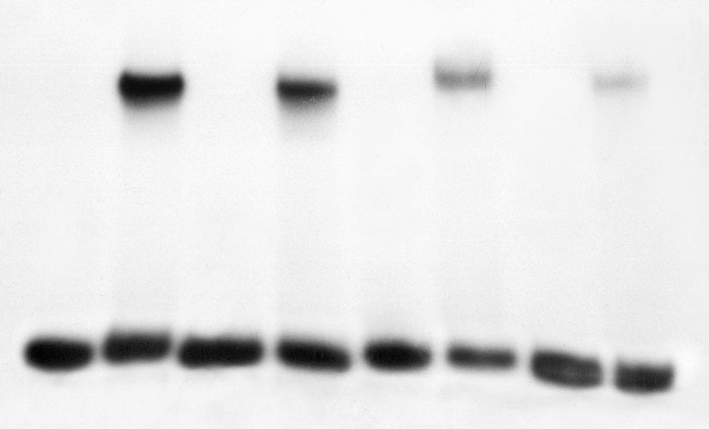 5. WYNIKI fragmenty promotorowego DNA o stężeniach : A1 89 ng/μl, O-10 40 ng/μl, O1/2-10 38 ng/μl, O-35 87 ng/μl, O-35/-10 35 ng/μl, O-35/1/2-10 36 ng/μl znakowane radioaktywnie na końcu 5.