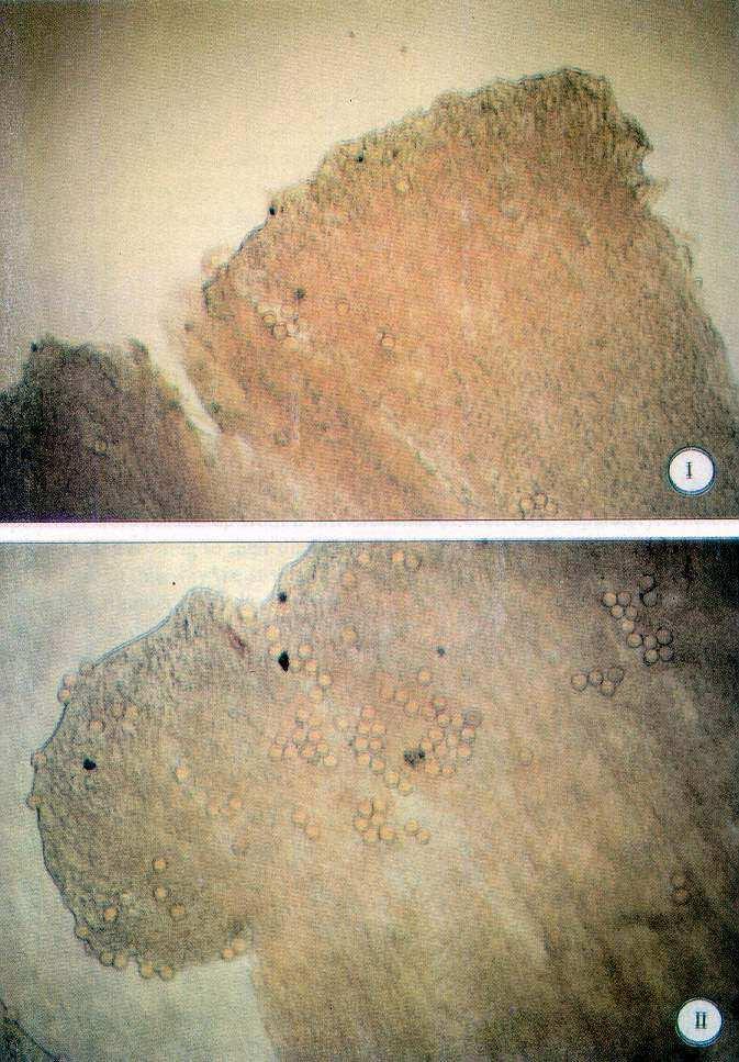 92 B. Denisow Phot. 2. Pollen grains on stigma in self-pollinated flowers of blackcurrant cultivars I Ben Tirran, II Titania ( 125) Fot.