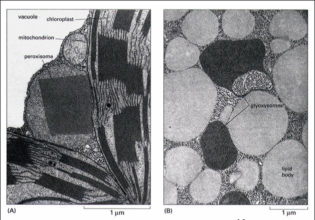 Peroksysomy Mikrografia elektronowa peroksysomów z komórek mezofilu