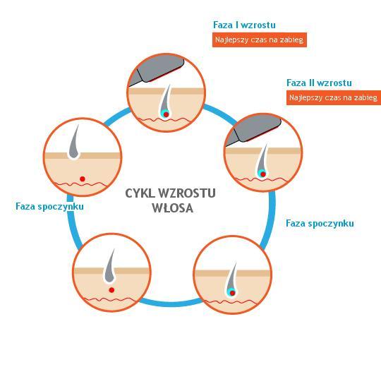 Uszkodzenie włosów w fazie anagenu Światło lasera oddziałuje tylko na włosy w fazie anagenu, więc konieczne jest powtarzanie zabiegu.