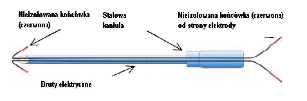 Sterylna para elektrod lub pojedyncza elektroda hakowa zostały włożone do igieł, a ich prawidłowa lokalizacja może zostać sprawdzona za pomocą stymulatora elektrycznego lub badania