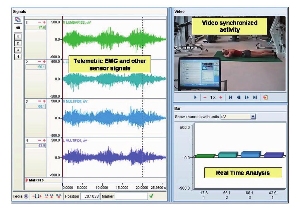 Świat Elektromiografii Monitorowanie aktywności i zachowania się mięśni w czasie rzeczywistym Oprogramowanie do zbierania danych Noraxon jest szeroko stosowane w naukach medycznych, biomechanice,